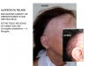 ALOPECIE1.jpg