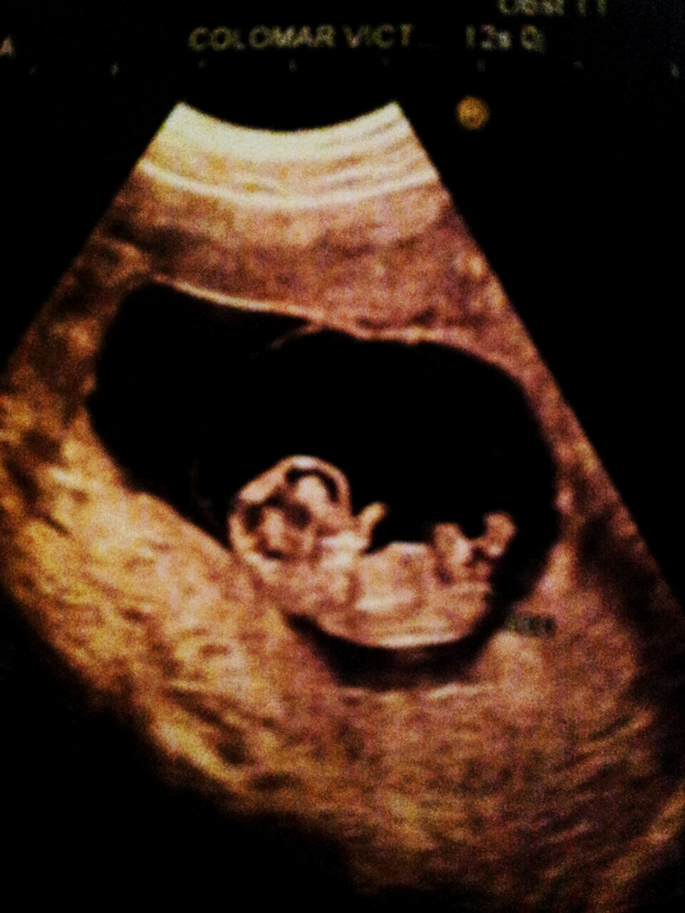 2013-03-09 18.17.48.jpg