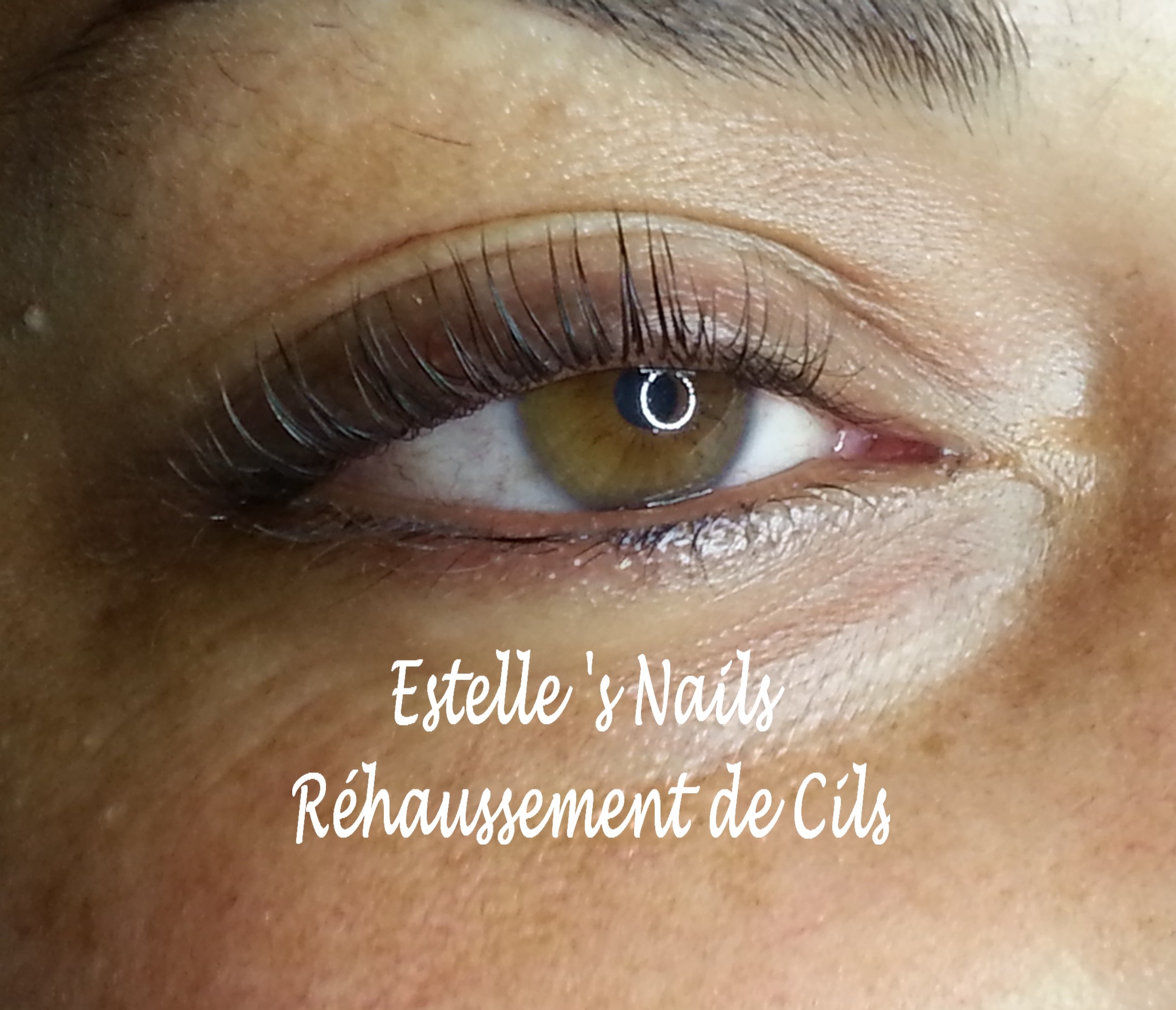 20130926_142658Gaby fac 1oeil après.jpg