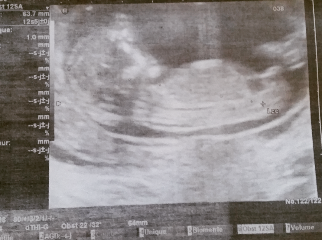 2015-11-07 12.25.43.png