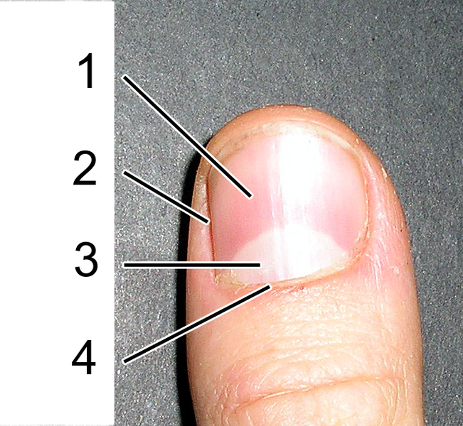 651px-Fingernail-Anatomia-externa-dumb2.png