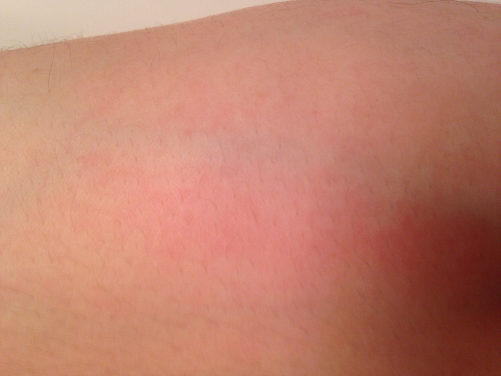 après gommage kessa.JPG