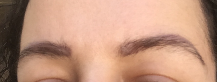 apres phiremoval.jpg