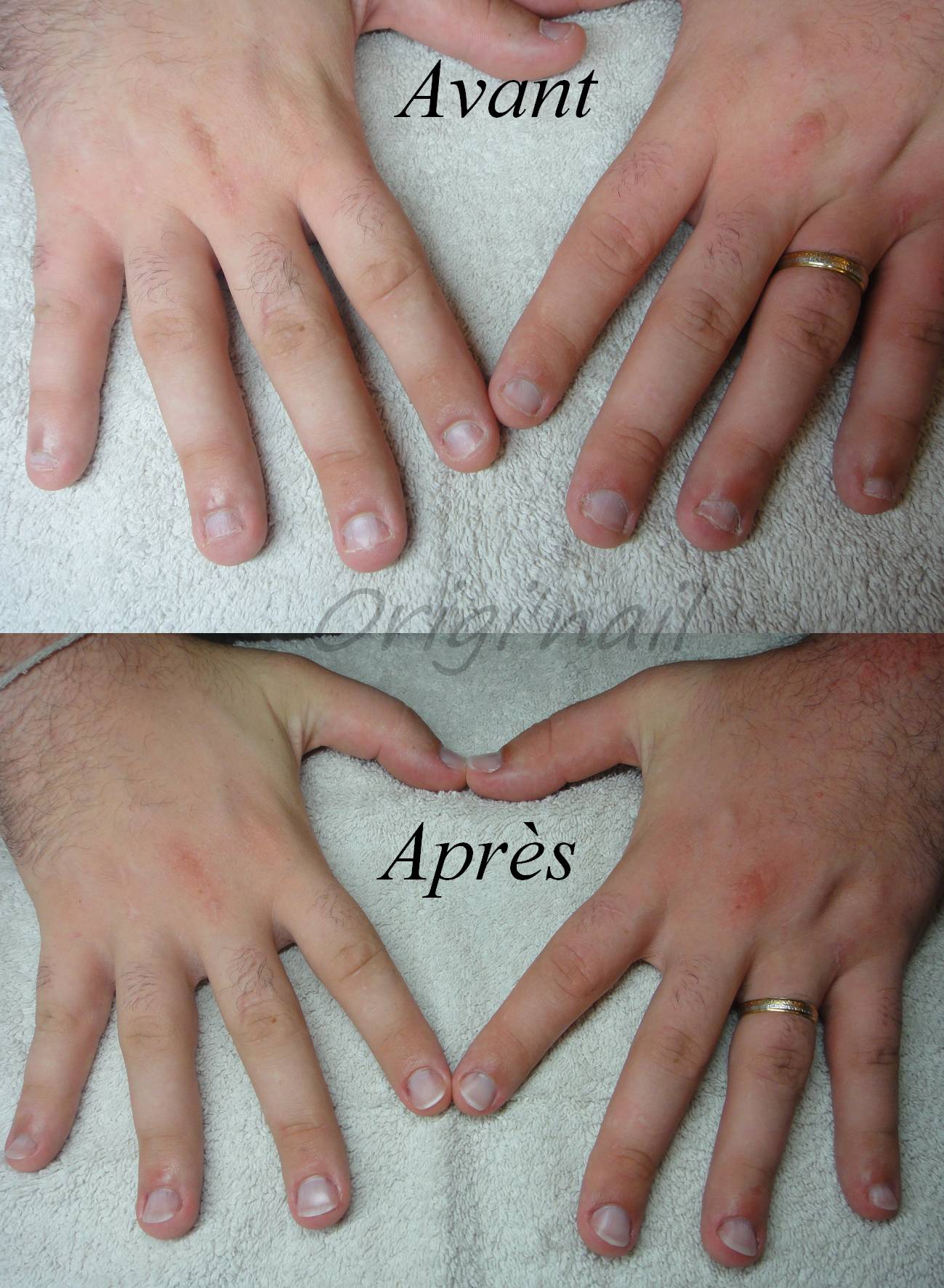 avant après homme 2.jpg