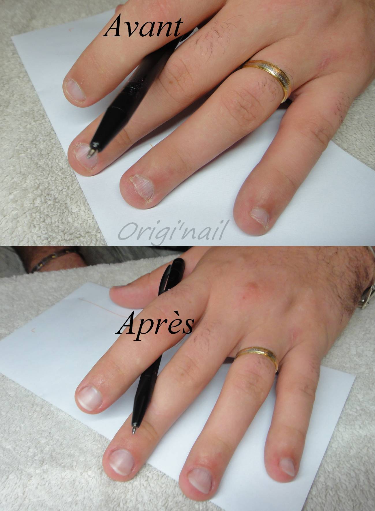 avant après homme.jpg