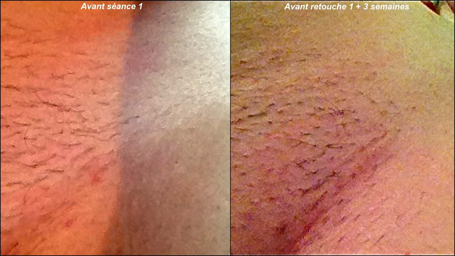 avant après maillot retouche 1.jpg