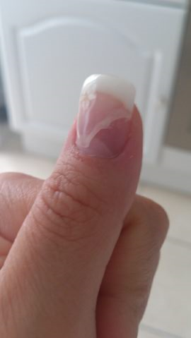 Décollement Laura.png