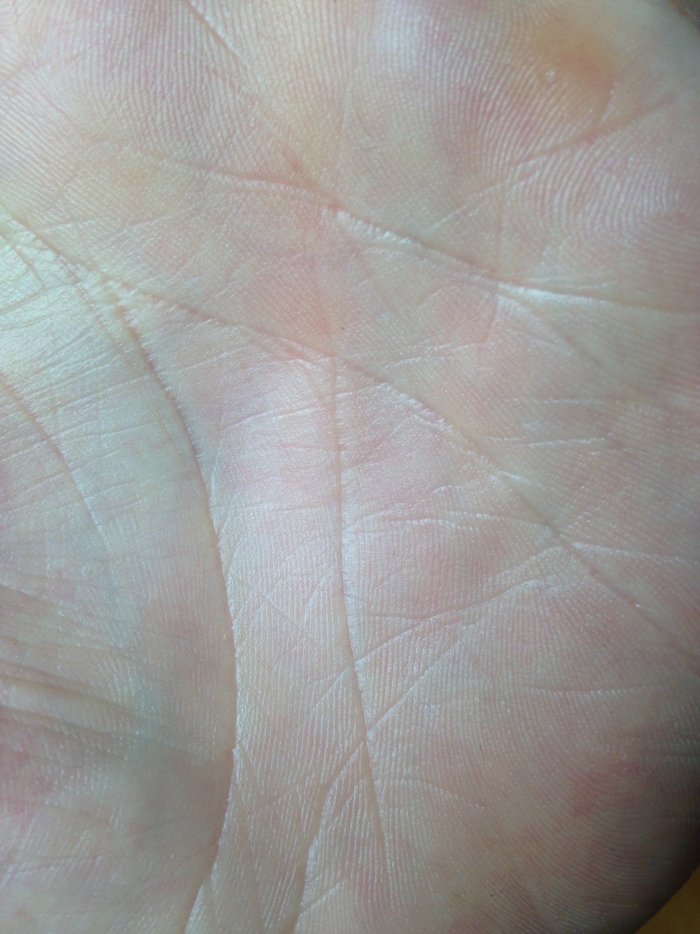 Hydra Bébé Corps-après.JPG