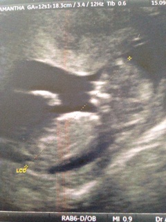 ImageUploadedByForum Manucure1442332265.134636.jpg