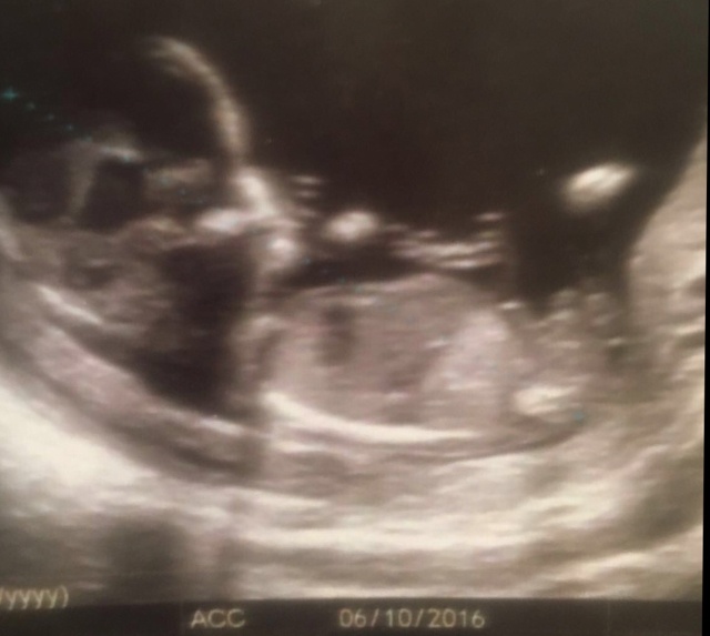 ImageUploadedByForum Manucure1459708776.075492.jpg