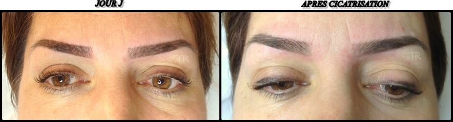 maquillage semi permanent cicatrisation avant apres.jpg