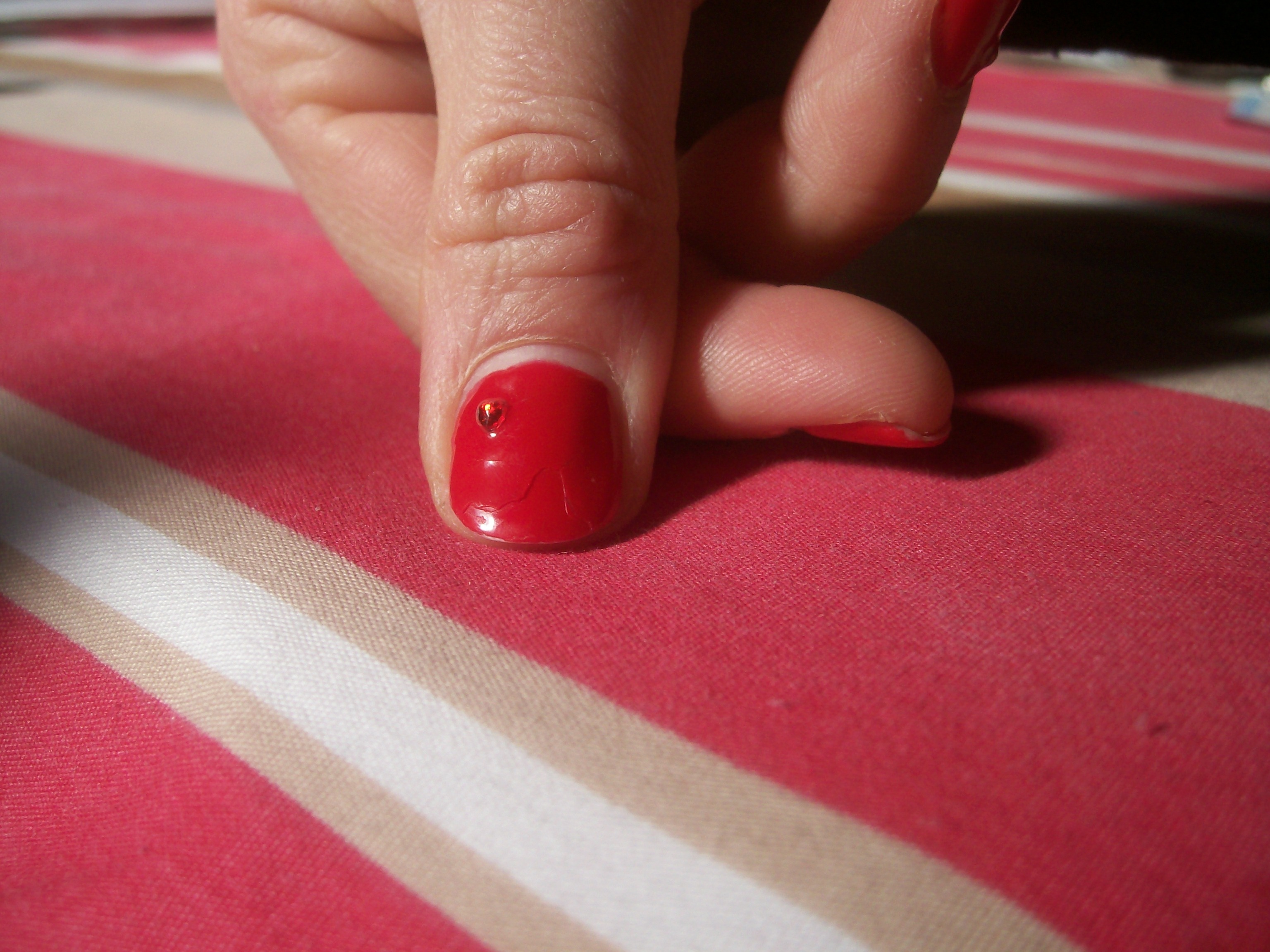 ongle cassé Christiane 001.jpg