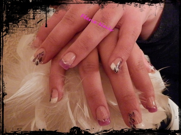 Pose capsules Pauline 16 mars 2013 montage.JPG