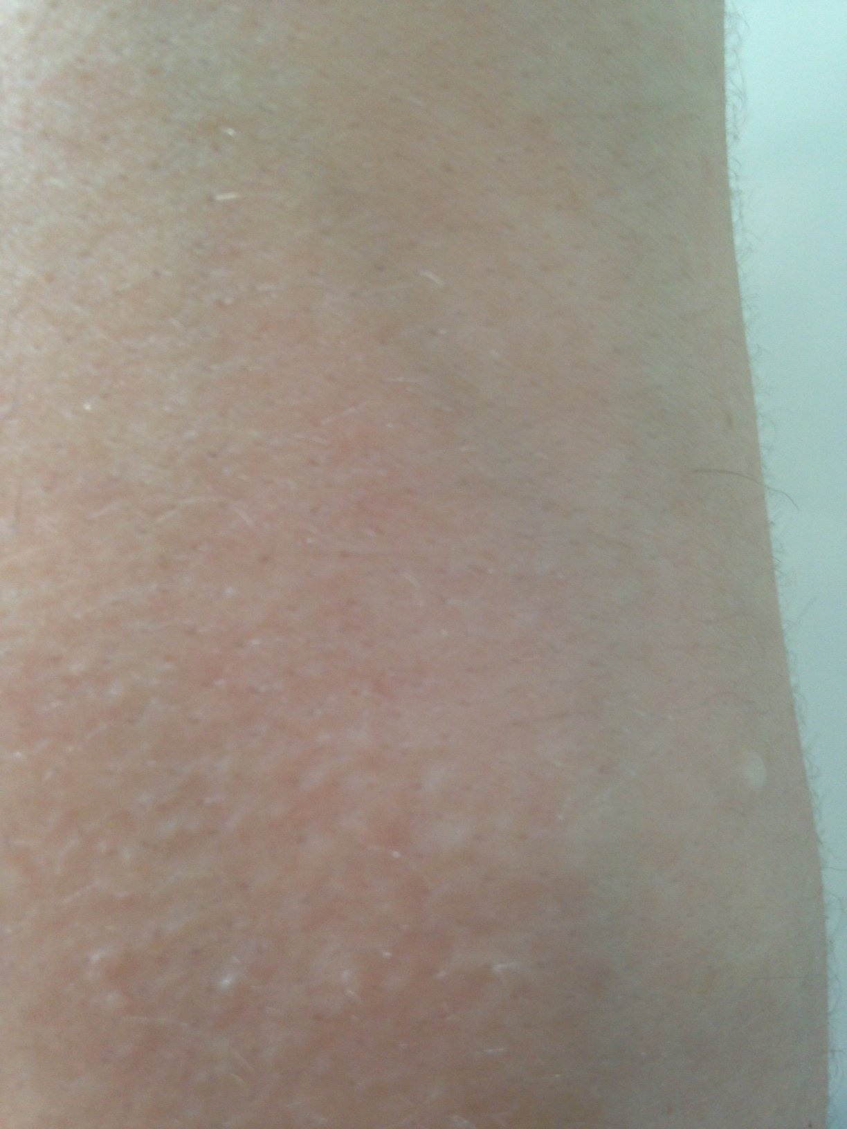 resultat sur la peau.JPG