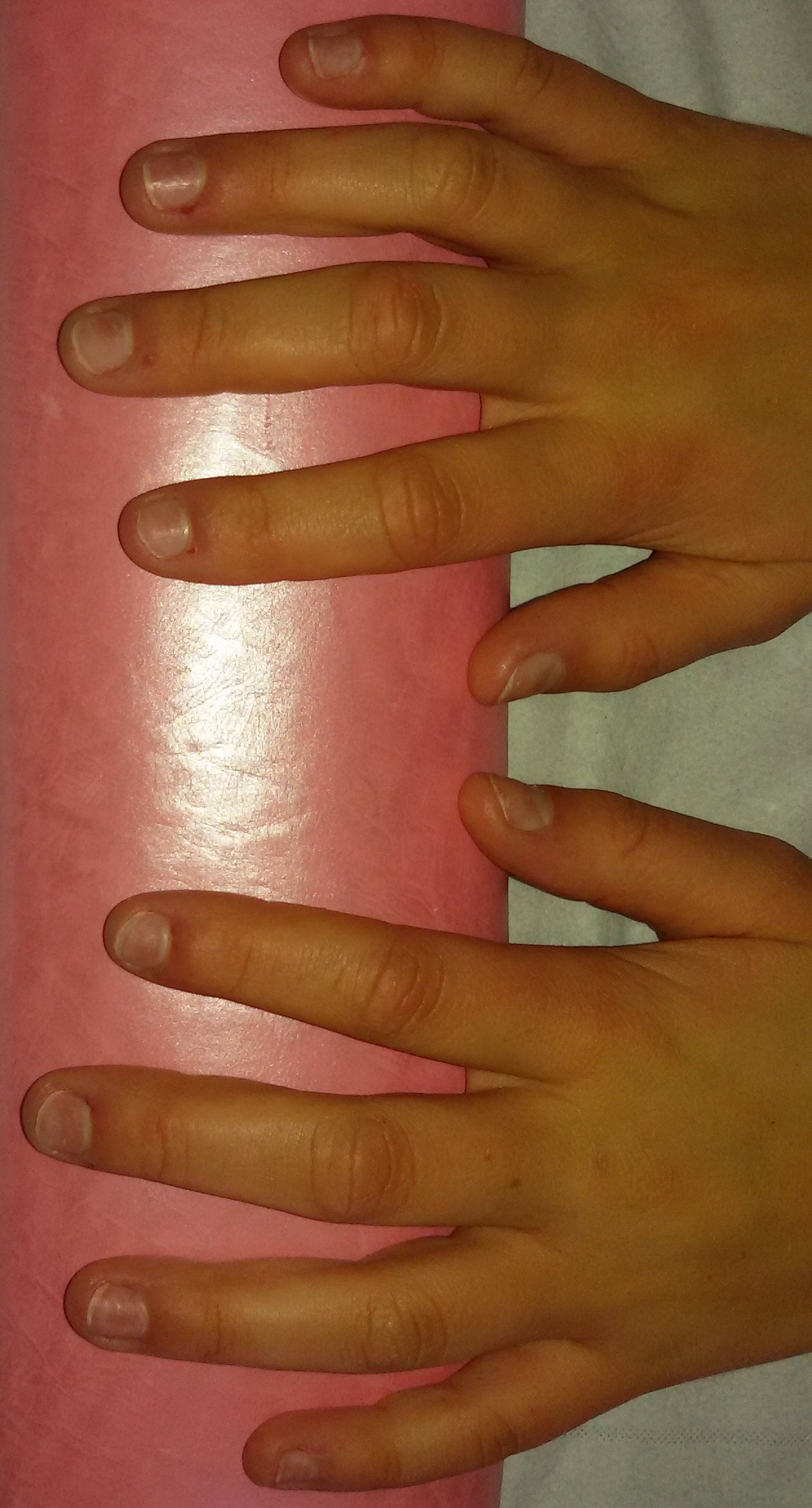 Sandrine avant 31.10.2014.jpg