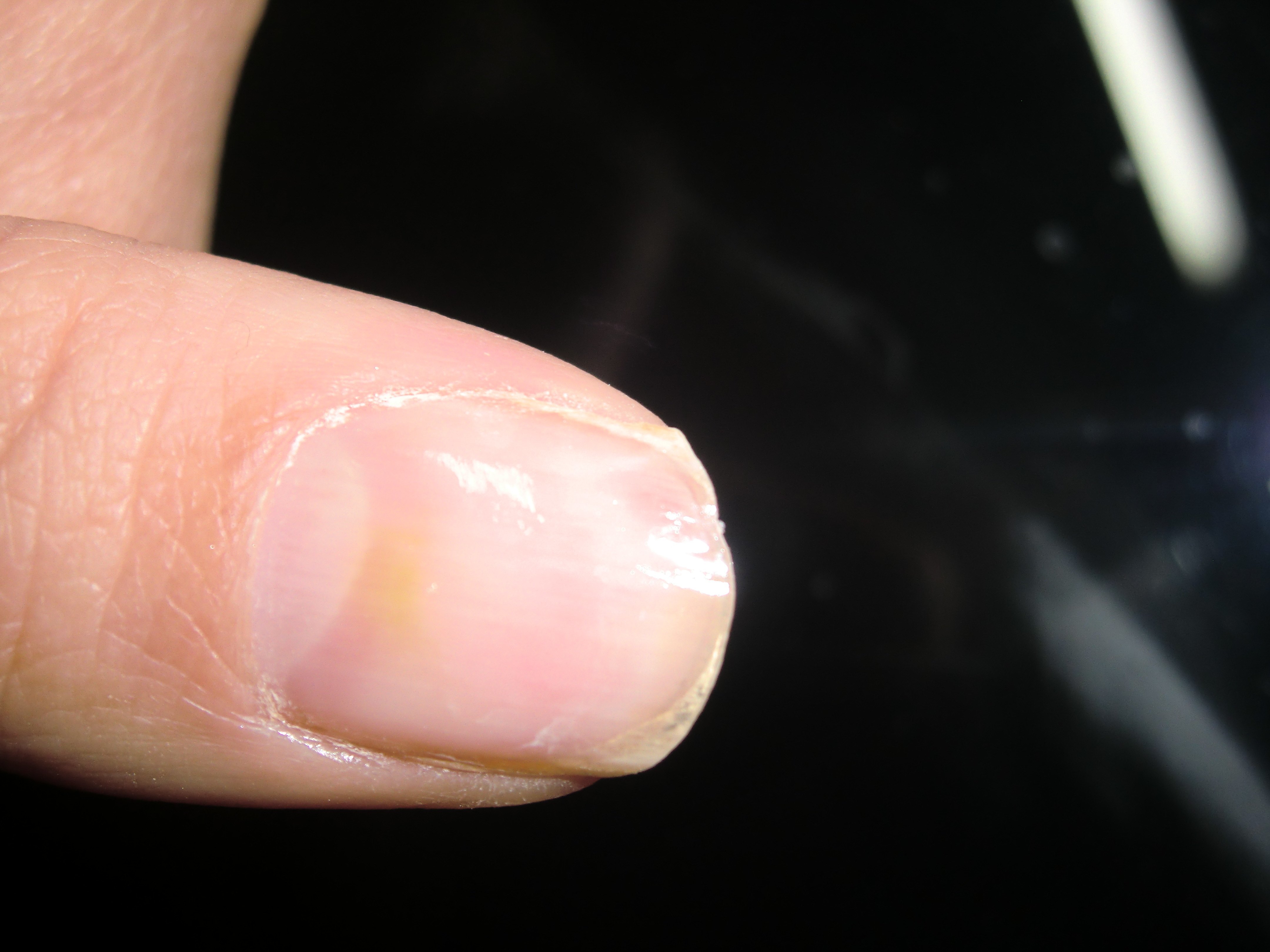 tache verte sur laetitia (1).JPG