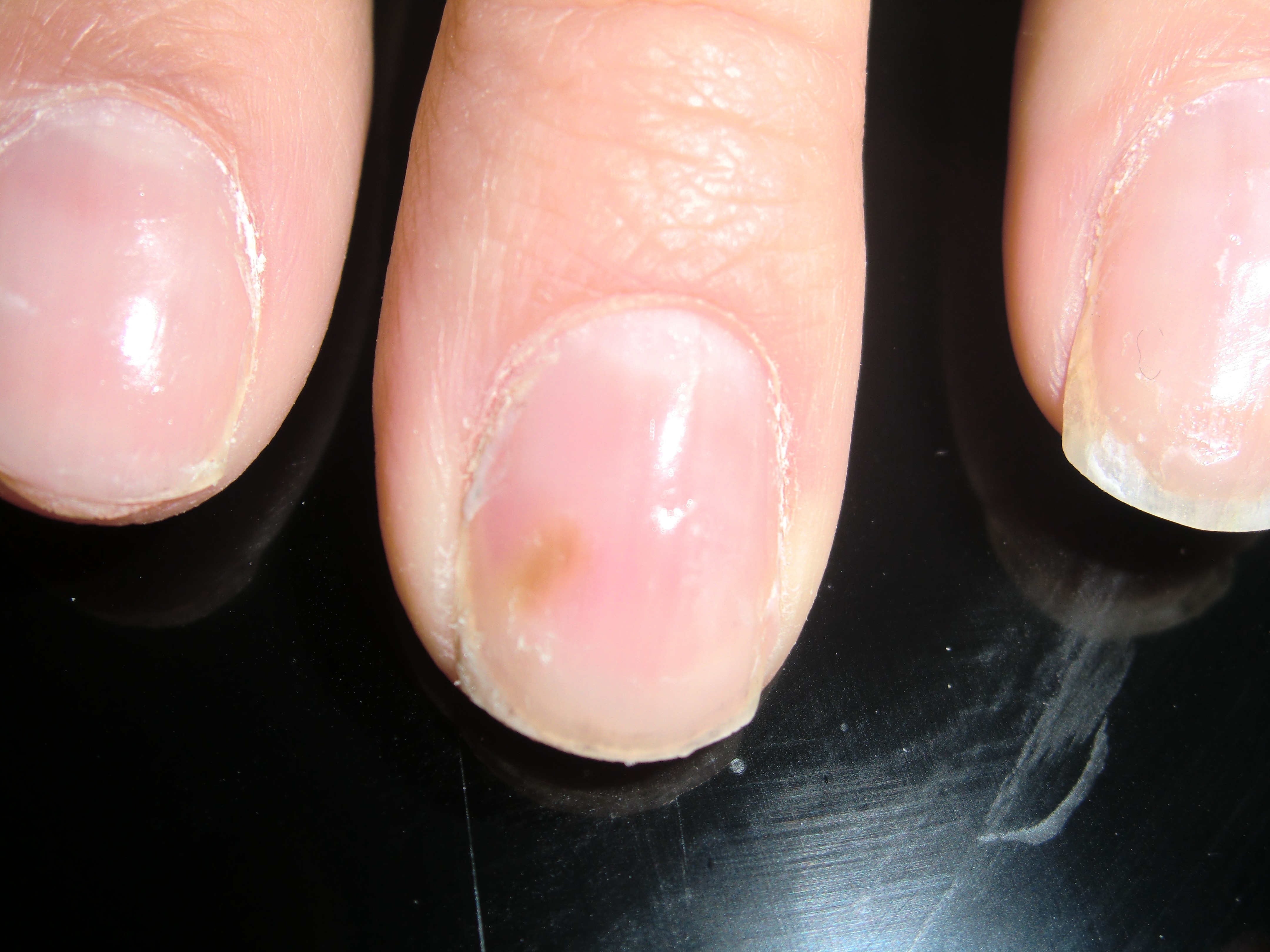 tache verte sur laetitia (2).JPG