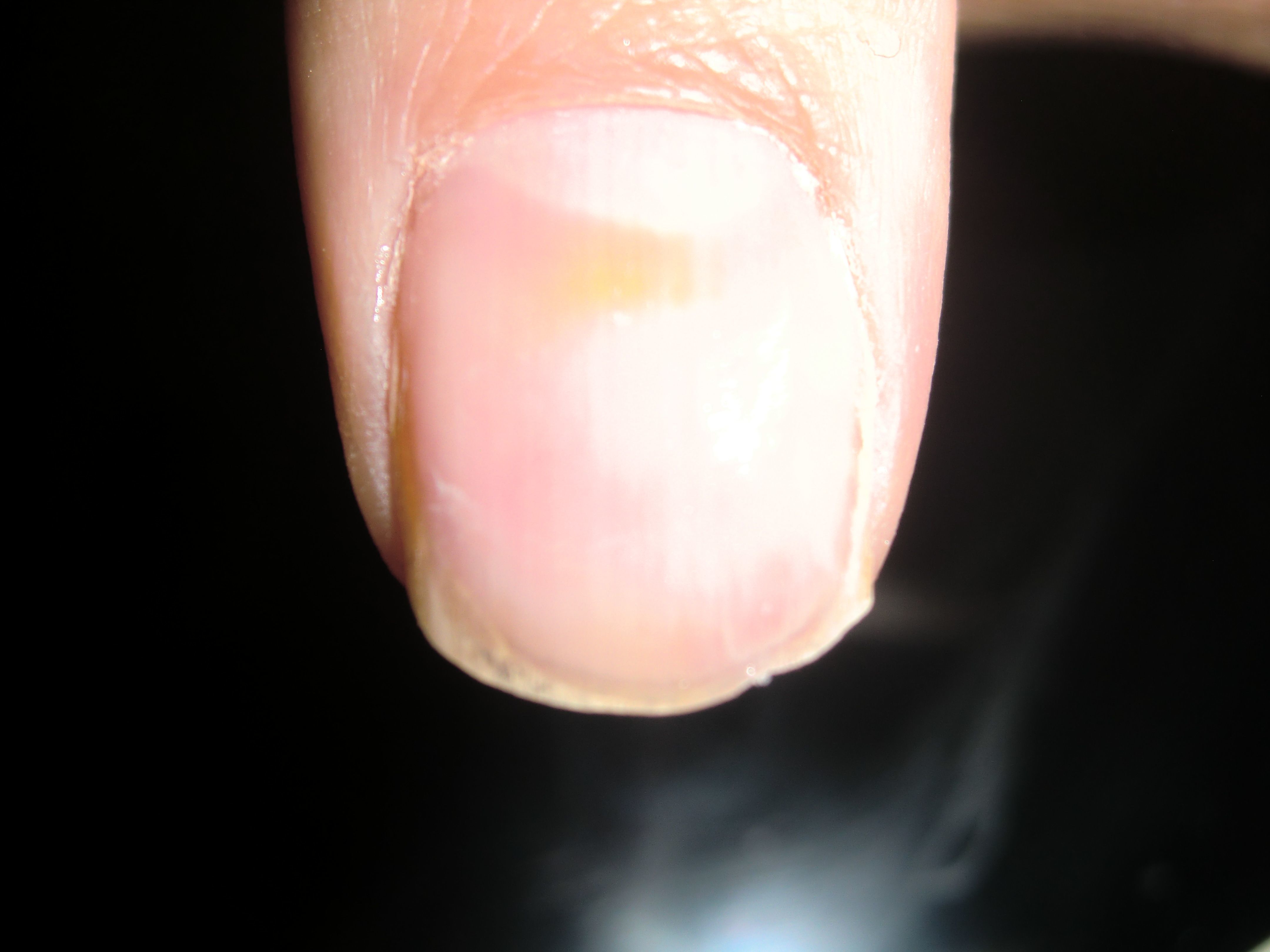 tache verte sur laetitia (3).JPG