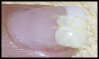 ongle déco 3D.jpg