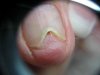 Poil ongle 003.jpg