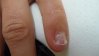 ongle ronge 002.jpg