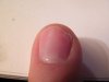 ongle.jpg