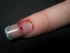 ongle cassé 001.jpg