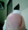 ongle cassé.jpg