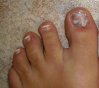 ongle  pied 006_édité.jpg
