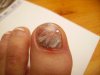 ongle  pied 012.jpg