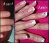 Ongle avant apres.jpg
