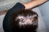 perte de cheveux 2 novembre 2010 002.jpg