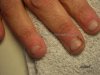 Ongles rongés.jpg