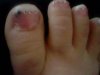 mes orteils 2.JPG