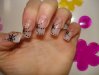 ongles pite noires.JPG