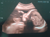 ForumRunner_20120727_221032.png