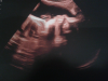 ForumRunner_20120808_221445.png