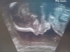 ForumRunner_20120906_184631.png
