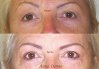 sourcils2.jpg