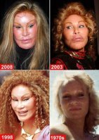 Jocelyn-Wildenstein-0-425x600.jpg