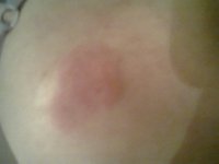 insecte omoplate.jpg