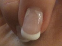 Décollement 2 jours V..jpg Décollement 2 jours V..jpg