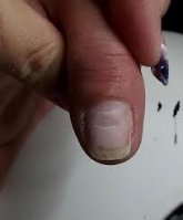 ongle abimé.jpg