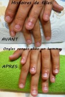 ongles rongés chez homme avant après.jpg