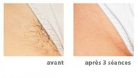 epilation-maillot.jpg