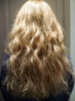 Cheveux avant toute operation.JPG