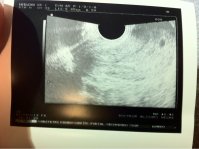 image-3594936911.jpg image-3594936911.jpg