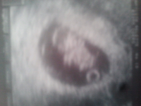 ForumRunner_20130416_104825.png ForumRunner_20130416_104825.png