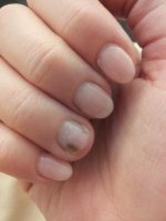 ongle_tache.jpg