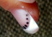 pouce decollement.JPG